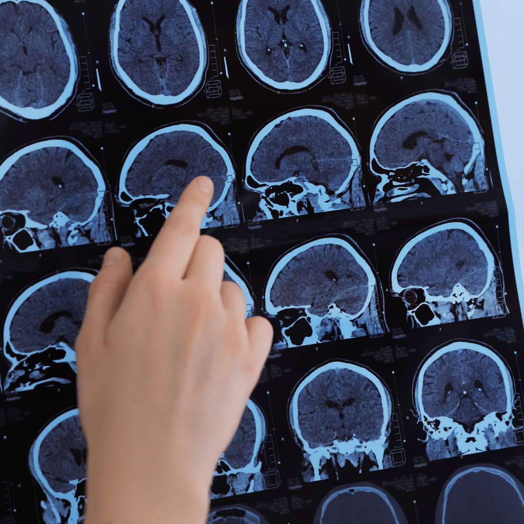 Health and care social research for MS Society